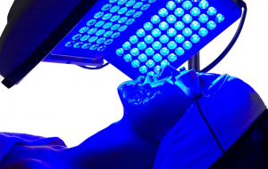 Blue Light LED Acne treatment